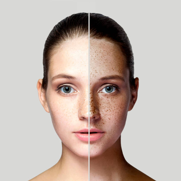 well health organic best ways to remove dark spots on face