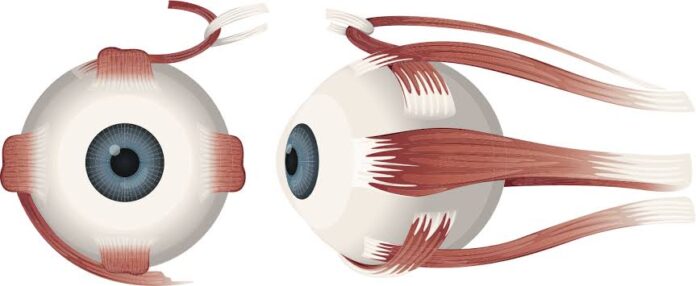 squint eye surgery