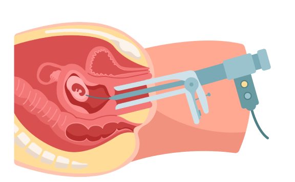 safe abortion clinic in Delhi